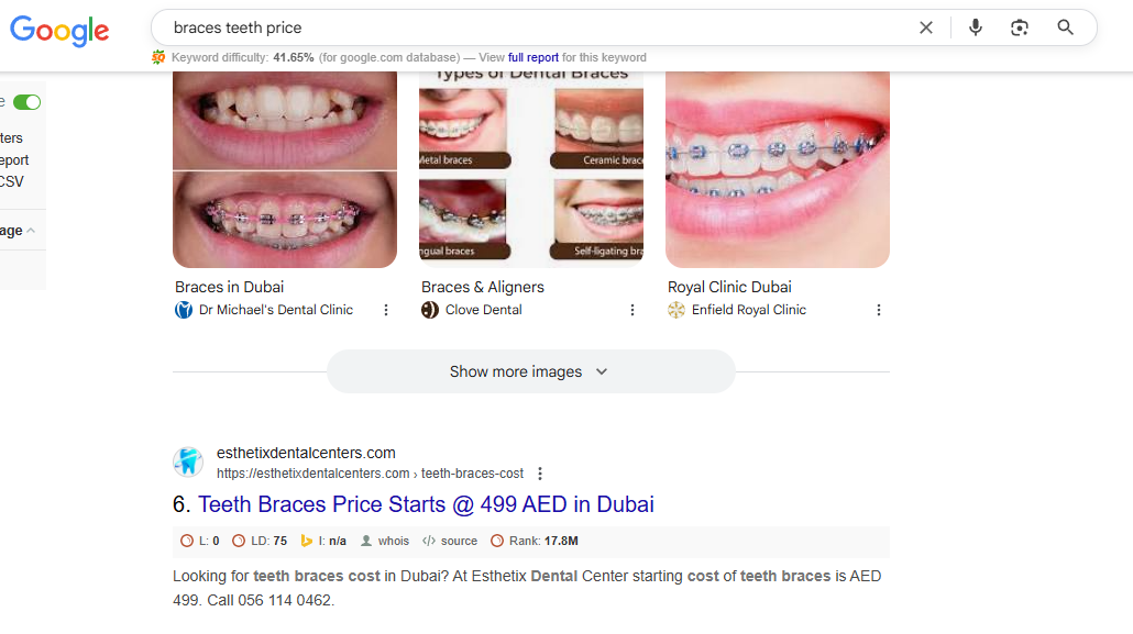 braces-teeth-price-keyword-ranking